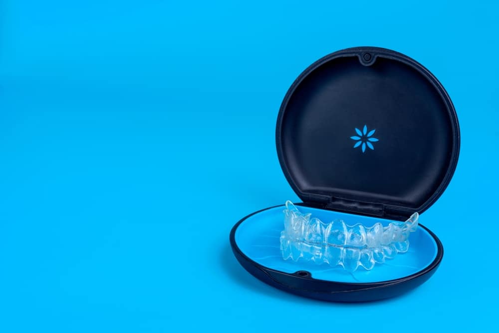 Invisalign clear aligners in Kitchener example